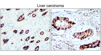 Cytokeratin 8 Rabbit Polyclonal Antibody