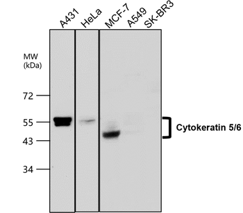 Cytokeratin 5 Rabbit Polyclonal Antibody