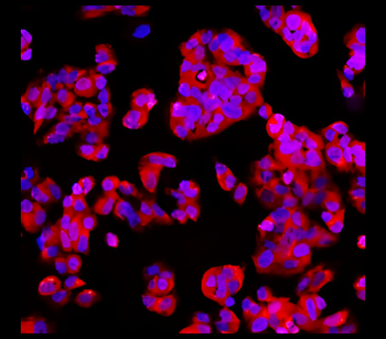 EpCAM/CD326 (Extracellular domain) Antibody