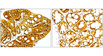 EpCAM/CD326 (Extracellular domain) Antibody