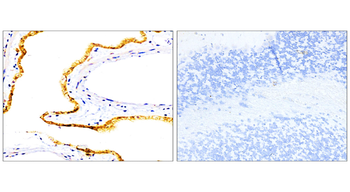 EpCAM/CD326 (Extracellular domain) Antibody