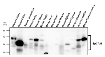 EpCAM/CD326 (Intracellular domain) Antibody