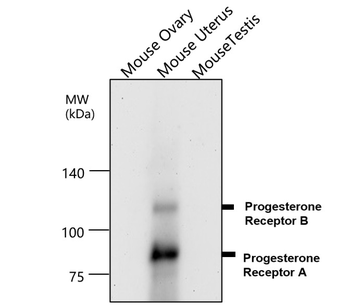 PGR Rabbit Polyclonal Antibody