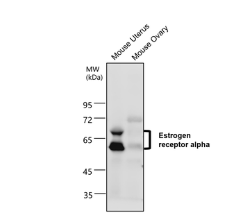 ESR1 Rabbit Polyclonal Antibody