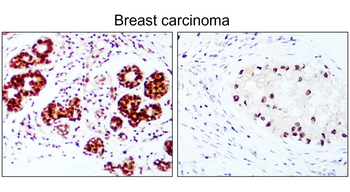 ESR1 Rabbit Polyclonal Antibody