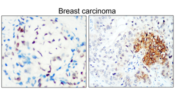 ESR1 Rabbit Polyclonal Antibody