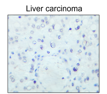 ESR1 Rabbit Polyclonal Antibody