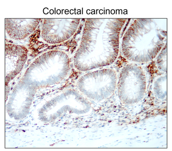 CD44 Rabbit Polyclonal Antibody