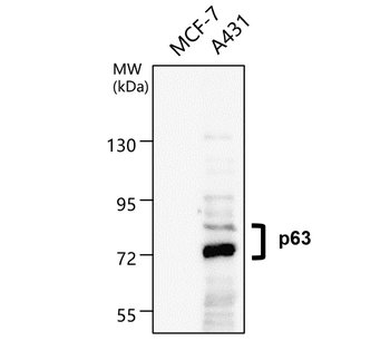 p63 Rabbit Polyclonal Antibody