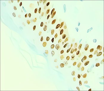 p63 Rabbit Polyclonal Antibody