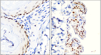 p63 Rabbit Polyclonal Antibody