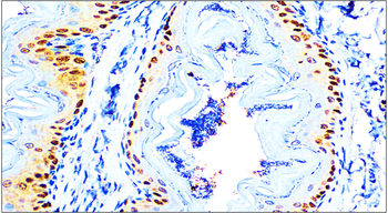 p63 Rabbit Polyclonal Antibody