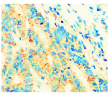 IKB alpha Rabbit Polyclonal Antibody