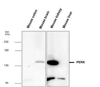 PERK Rabbit Polyclonal Antibody