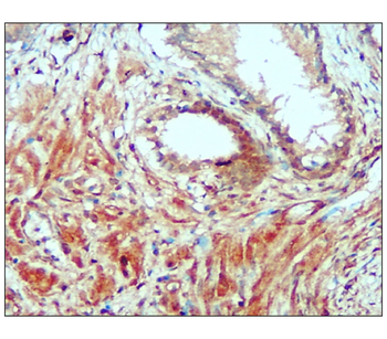 PERK Rabbit Polyclonal Antibody