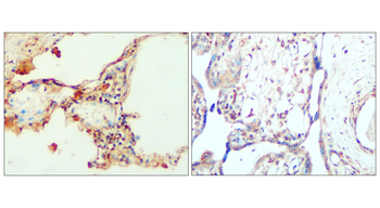 PERK Rabbit Polyclonal Antibody
