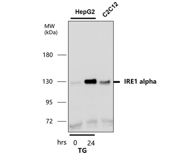 IRE1α Rabbit Polyclonal Antibody