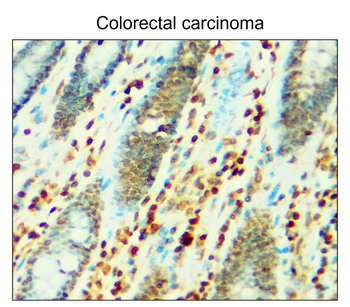 p21 Waf1 Rabbit Polyclonal Antibody