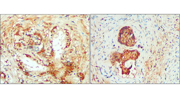 IL-1 beta Rabbit Polyclonal Antibody