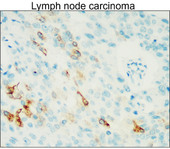 COX2 Rabbit Polyclonal Antibody