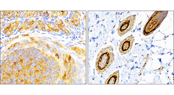 SQSTM1/P62 Antibody