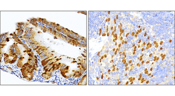 SQSTM1/P62 Antibody