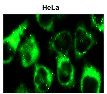 SQSTM1/P62 Antibody