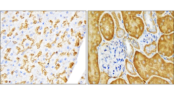 SQSTM1/P62 Antibody