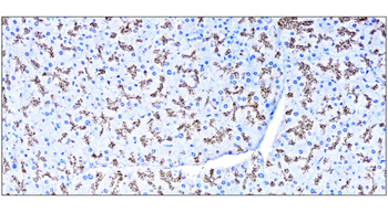 SQSTM1/P62 Antibody