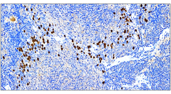 SQSTM1/P62 Antibody
