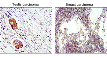 LC3B Antibody