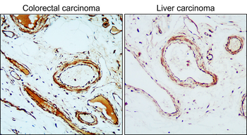 VEGFR2/KDR/CD309 Antibody
