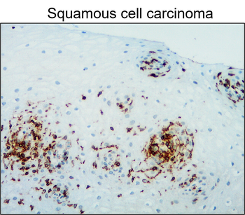 CD45 (Intracellular) Antibody