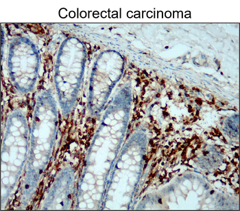 CD45 (Intracellular) Antibody