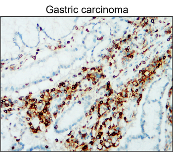 CD45 (Intracellular) Antibody