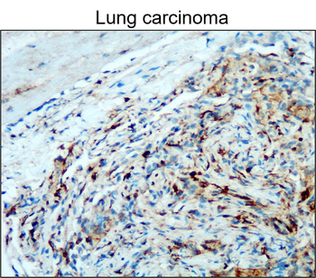CD45 (Intracellular) Antibody