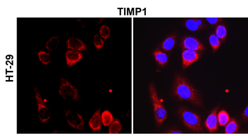 TIMP1 Antibody