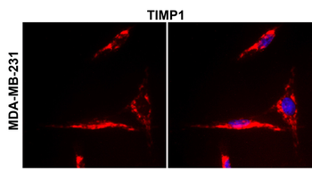 TIMP1 Antibody