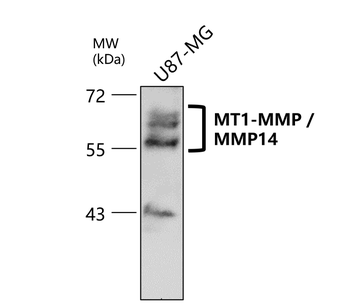 MMP14 Rabbit Polyclonal Antibody