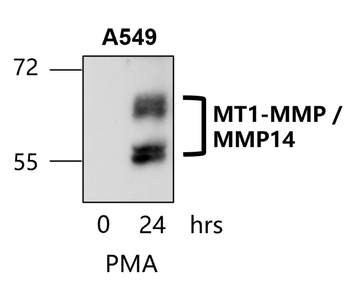 MMP14 Rabbit Polyclonal Antibody