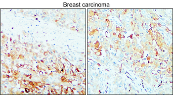 MMP14 Rabbit Polyclonal Antibody