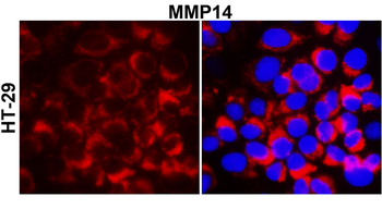 MMP14 Rabbit Polyclonal Antibody