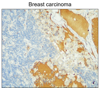 MMP14 Rabbit Polyclonal Antibody