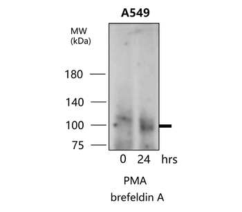 MMP9 Antibody