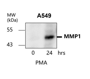 MMP1 Rabbit Polyclonal Antibody