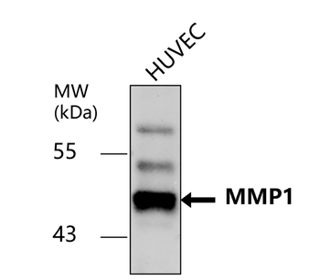 MMP1 Rabbit Polyclonal Antibody