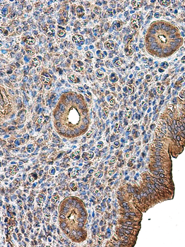Paxillin Rabbit Polyclonal Antibody