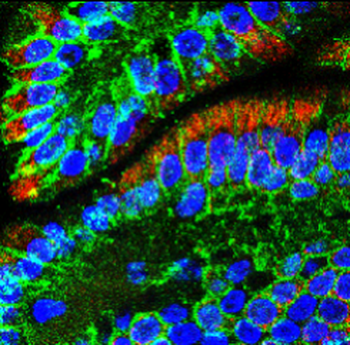 E-cadherin (Intracellular) Antibody