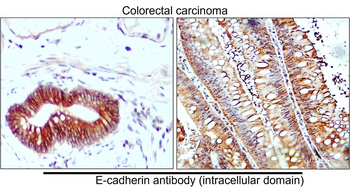 E-cadherin (Intracellular) Antibody