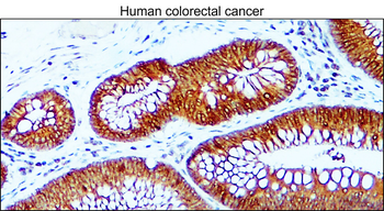 E-cadherin (Intracellular) Antibody